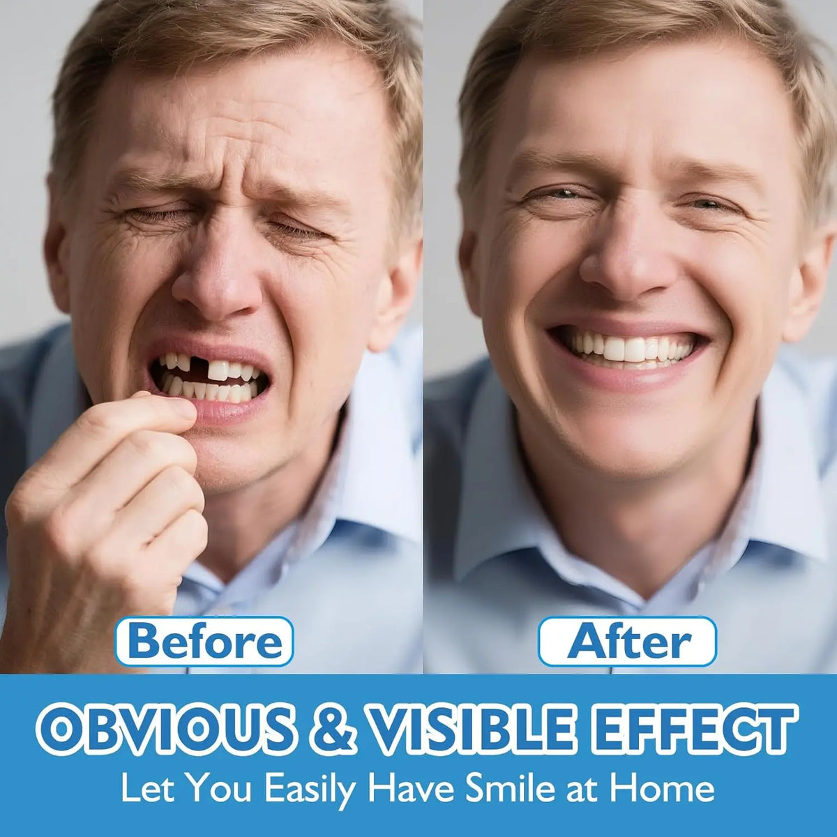 Comfort Fit Snap-On Smile Veneers for Realistic Teeth