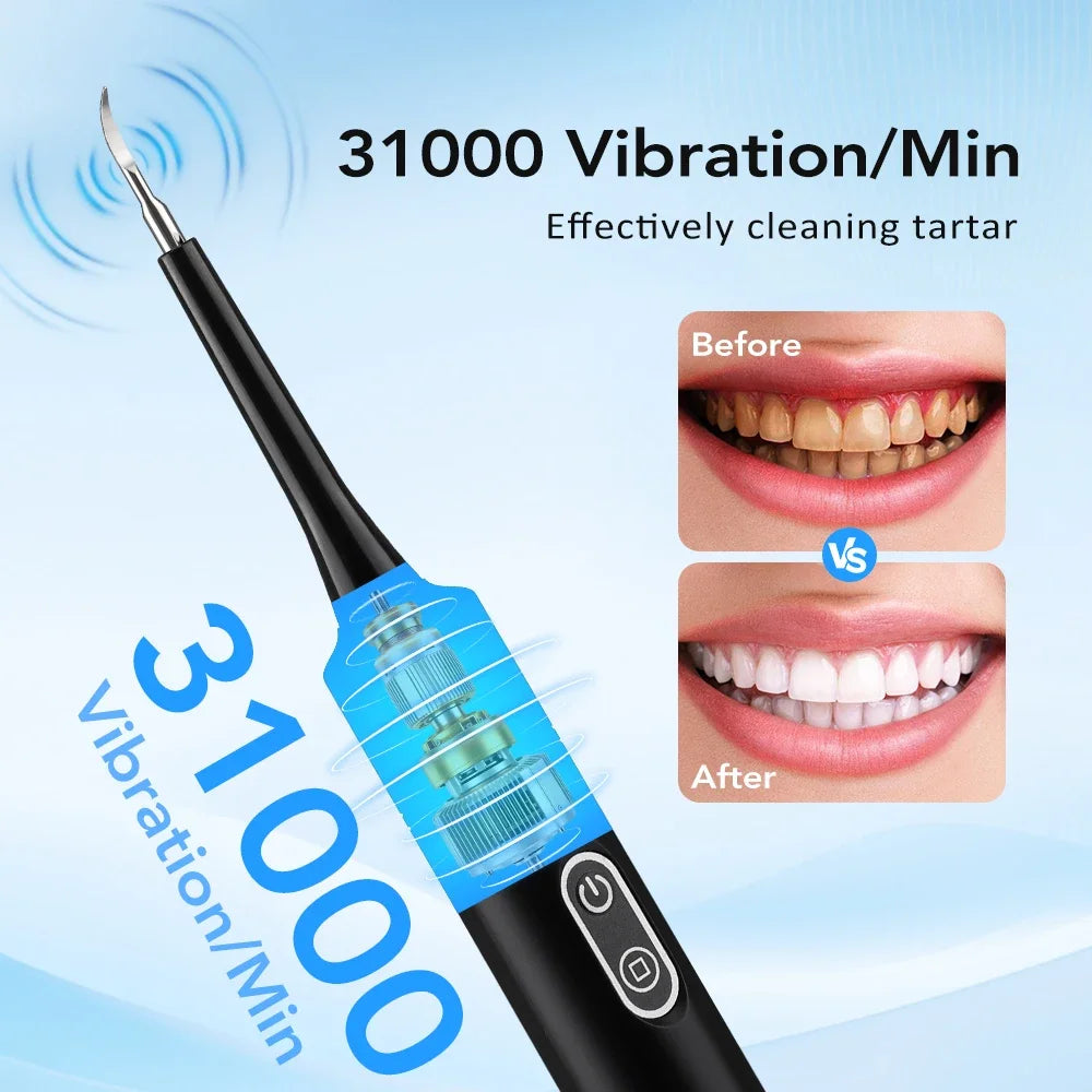 Electric Sonic Teeth Cleaner and Plaque Remover - 3