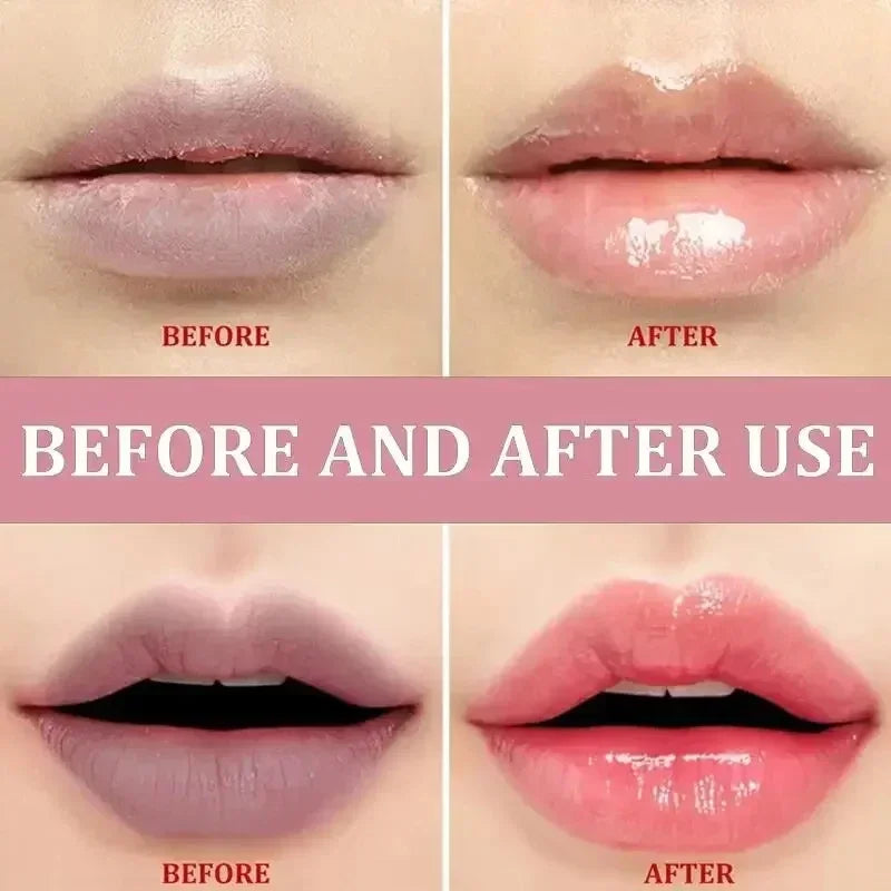 Moisturizing Lip Balm for Dark Lip Correction and Repair