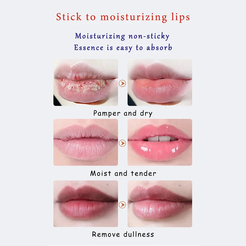 Moisturizing Lip Balm for Dark Lip Correction and Repair - 2