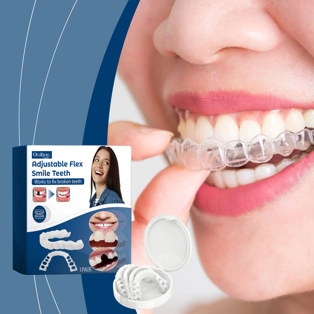 Adjustable Snap-On Smile Veneers for Missing or Broken Teeth