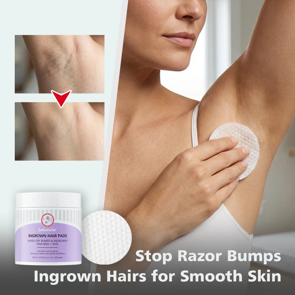 Exfoliating Ingrown Hair Treatment Pads for Razor Bumps - 11