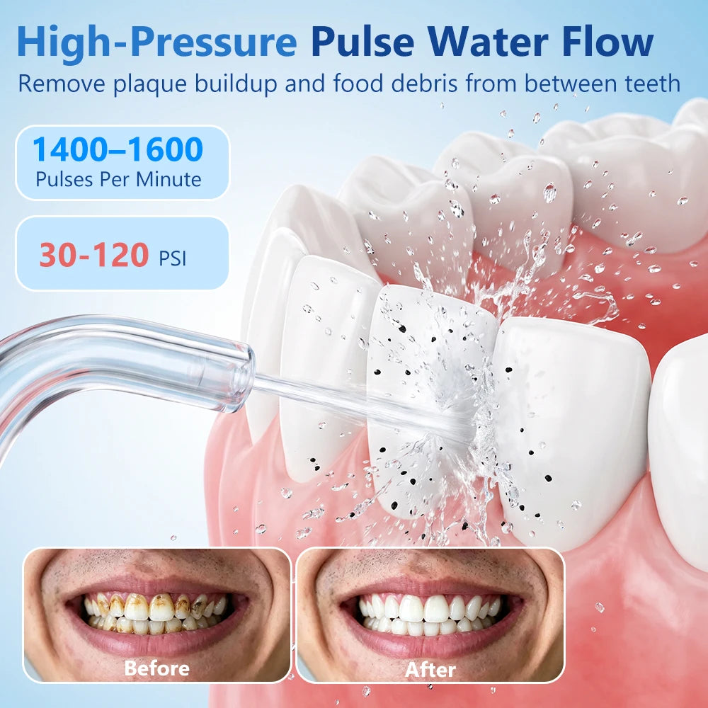 Cordless Water Dental Flosser for Teeth and Braces Cleaning - 3