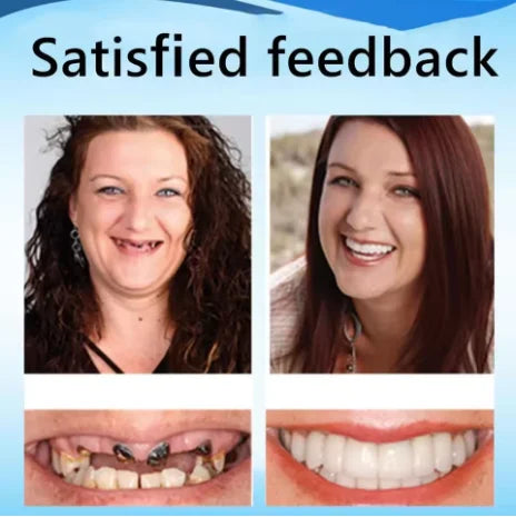 Custom Fit Boil and Shape Comfort Dentures - 5