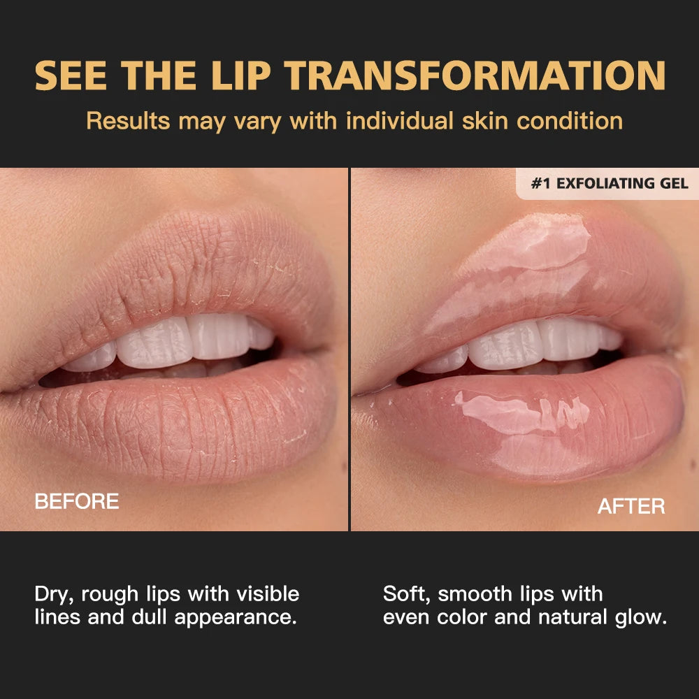 4-Step Complete Lip Care and Hydration Treatment Set - 10