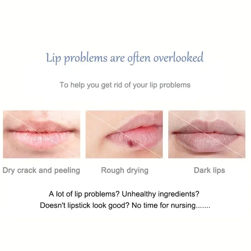 Moisturizing Lip Balm for Dark Lip Correction and Repair - 7