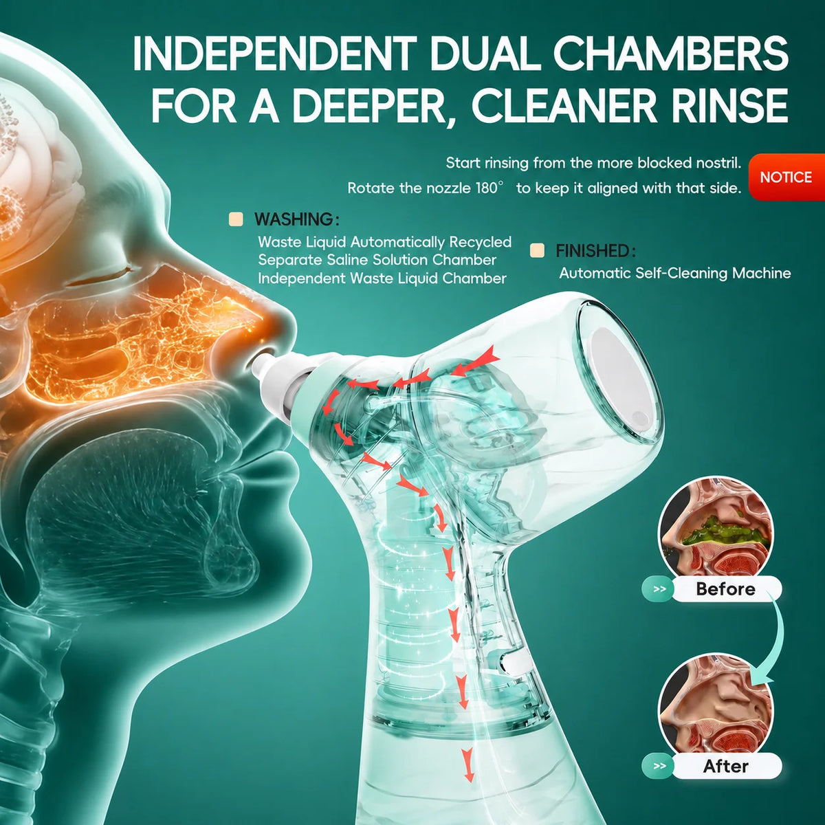 Electric Nasal Irrigator for Sinus Congestion Relief