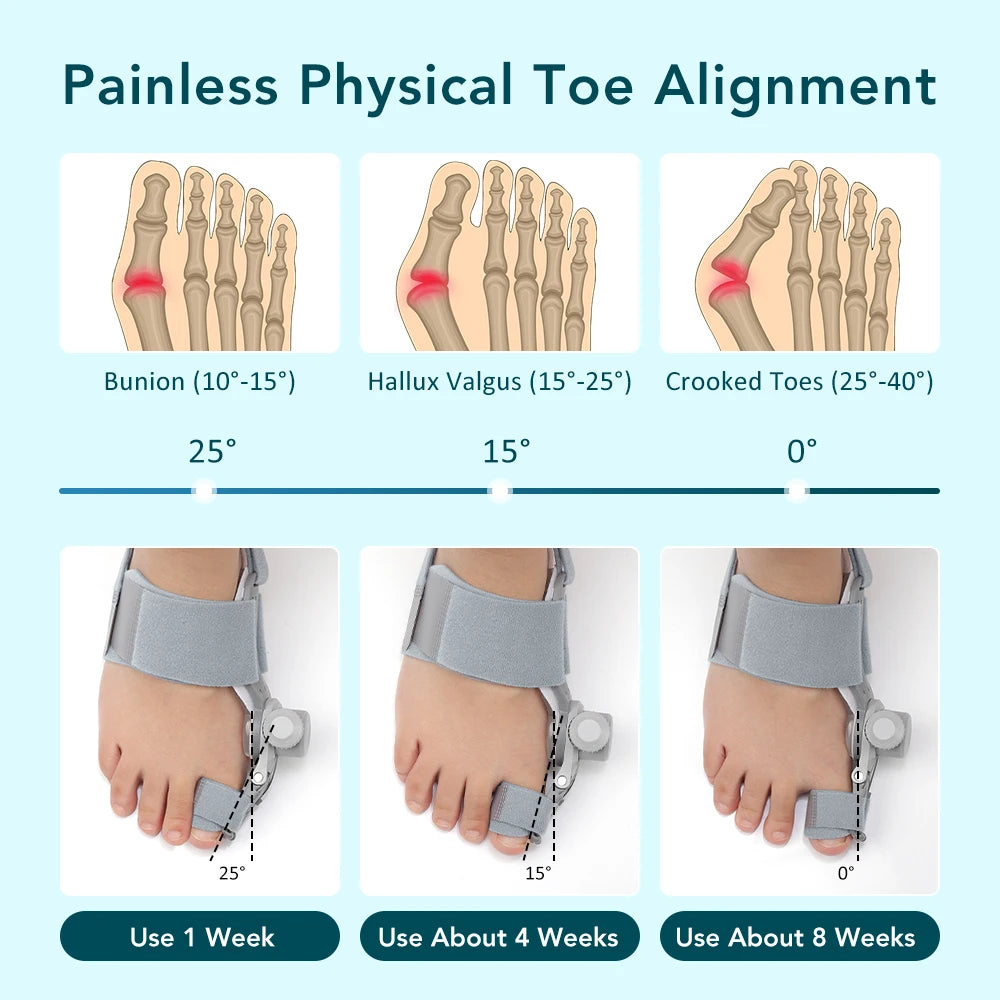 Adjustable Bunion Corrector and Toe Straightener - 15