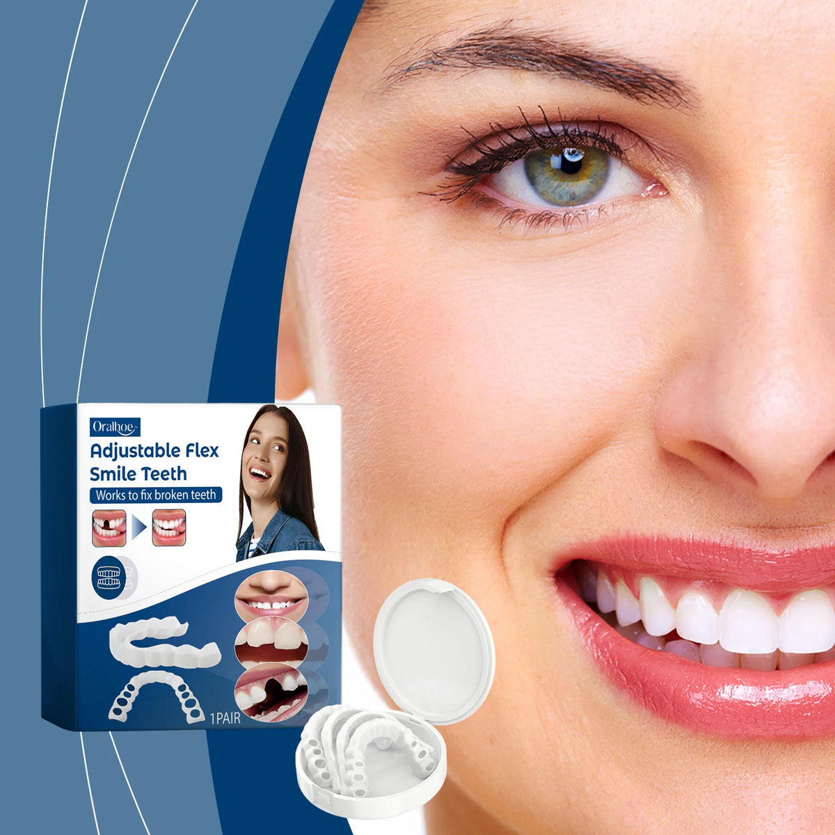 Adjustable Snap-On Smile Veneers for Missing or Broken Teeth