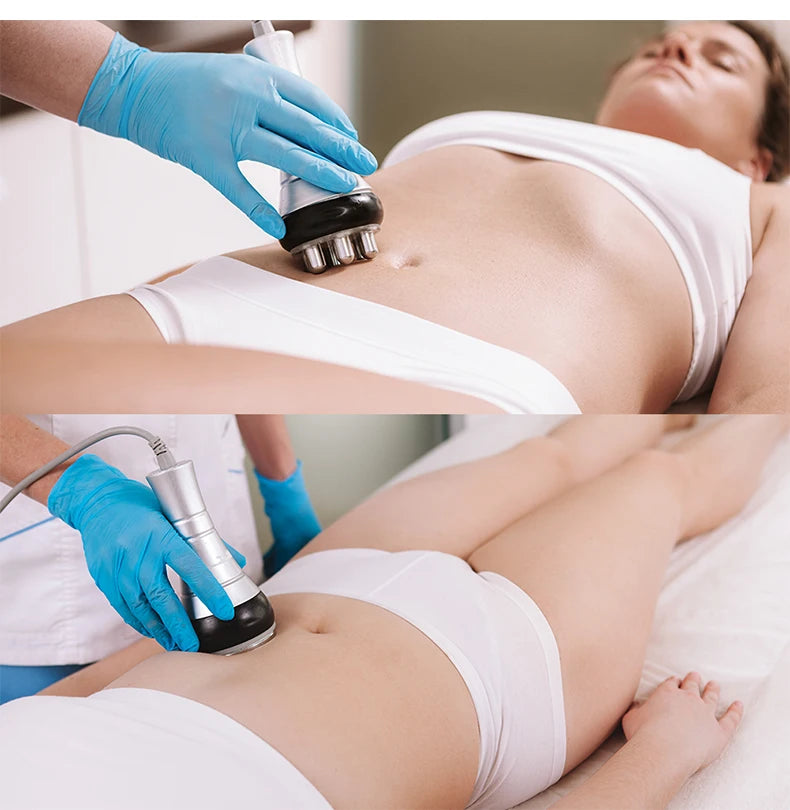40K Ultrasonic Cavitation and RF Body Slimming and Lifting Machine