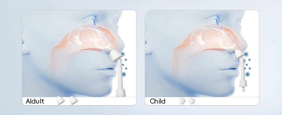 Electric Nasal Irrigator and Sinus Rinse System