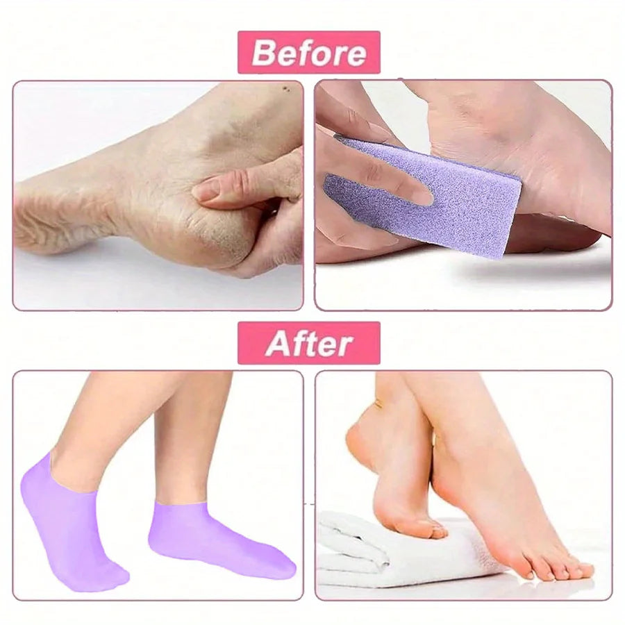 Silicone Moisturizing Socks for Dry Cracked Feet - 5