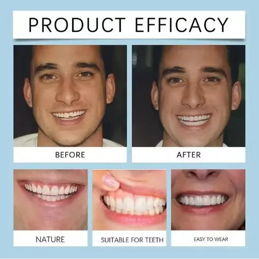 Flexible Silicone Denture Set for Natural Smile Replacement - 5