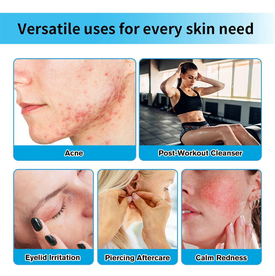 Hypochlorous Acid Soothing Facial Spray for Acne and Sensitive Skin