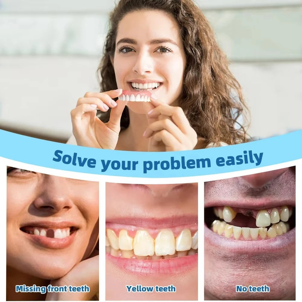 Custom-Fit Silicone Cosmetic Teeth Veneers