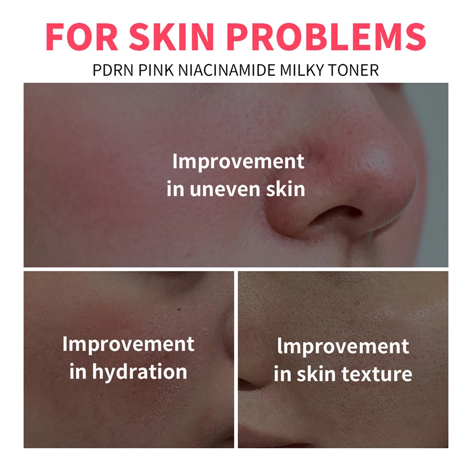 PDRN Niacinamide Milky Toner for Radiant Hydrated Skin