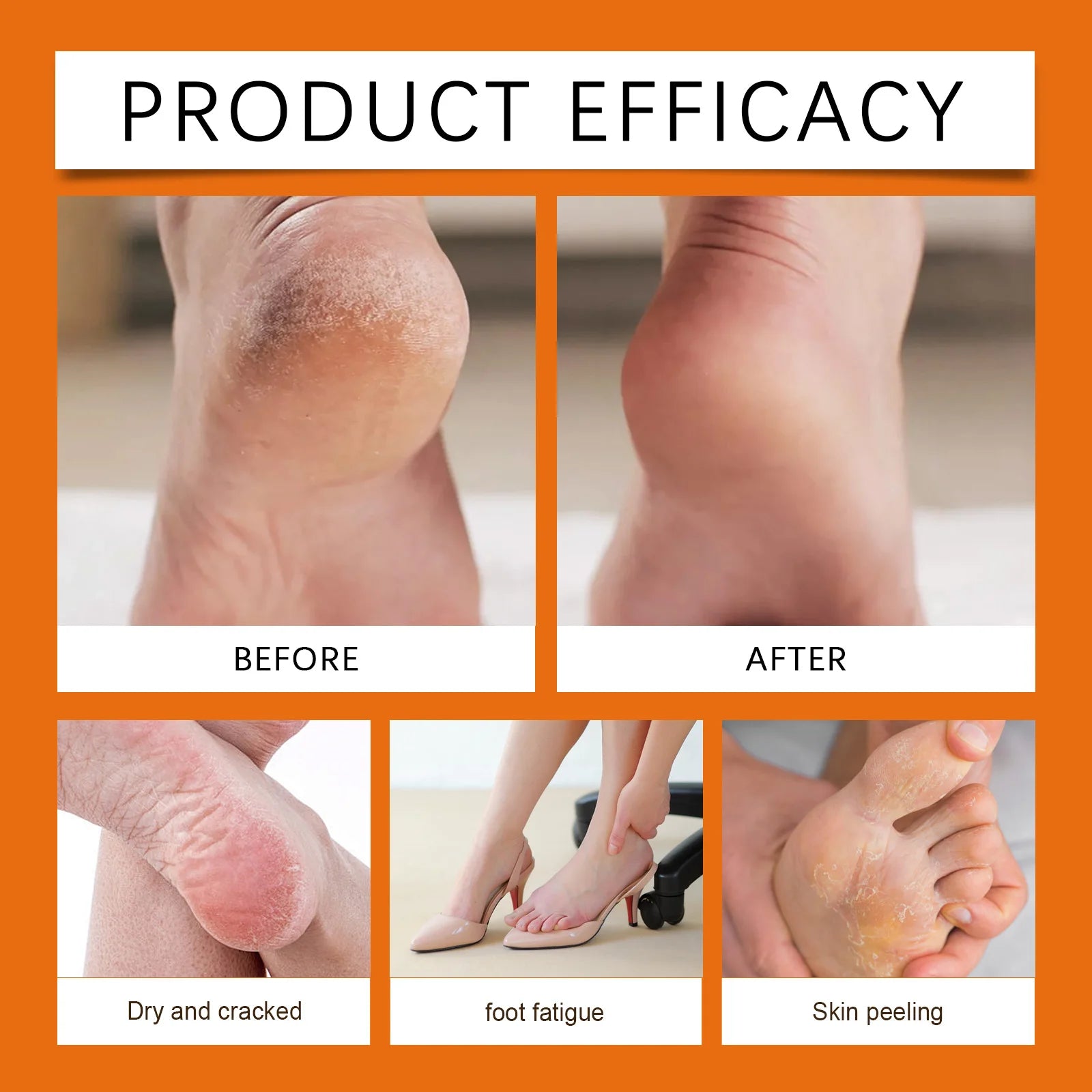 Moisturizing Honey Heel and Hand Repair Balm - 4