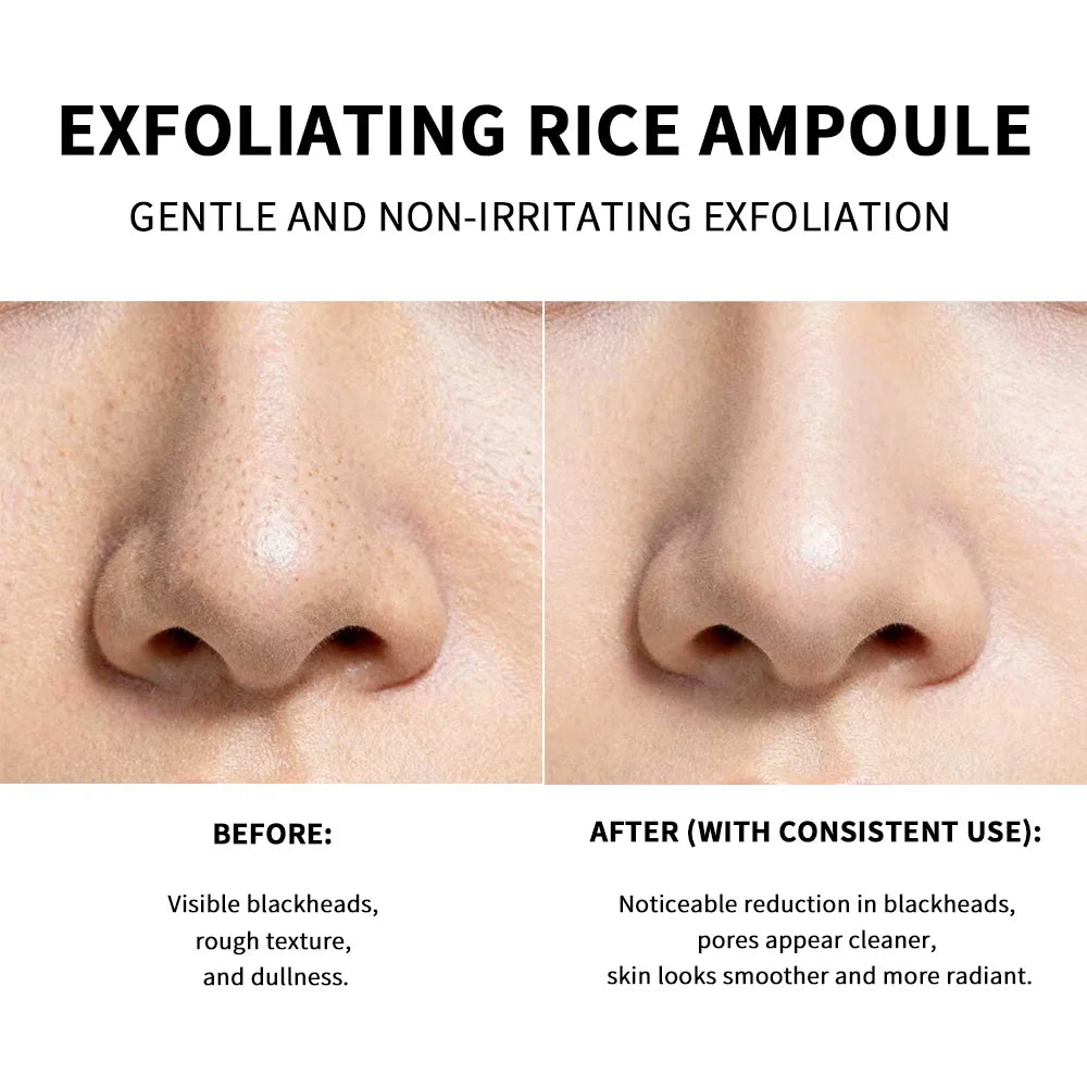 Exfoliating Rice Skin Brightening and Pore Cleansing Essence - 5