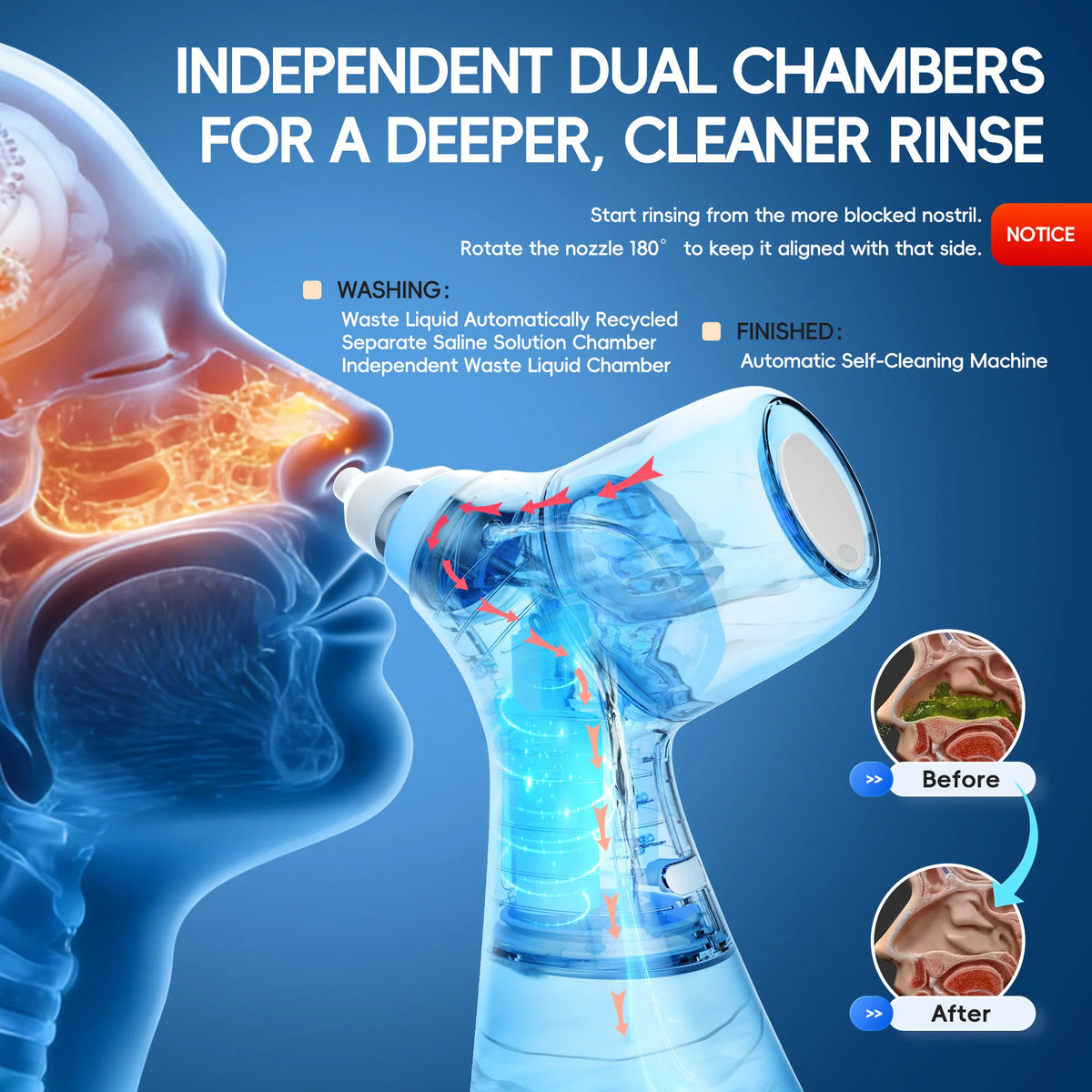 Electric Nasal Irrigation System for Sinus Relief