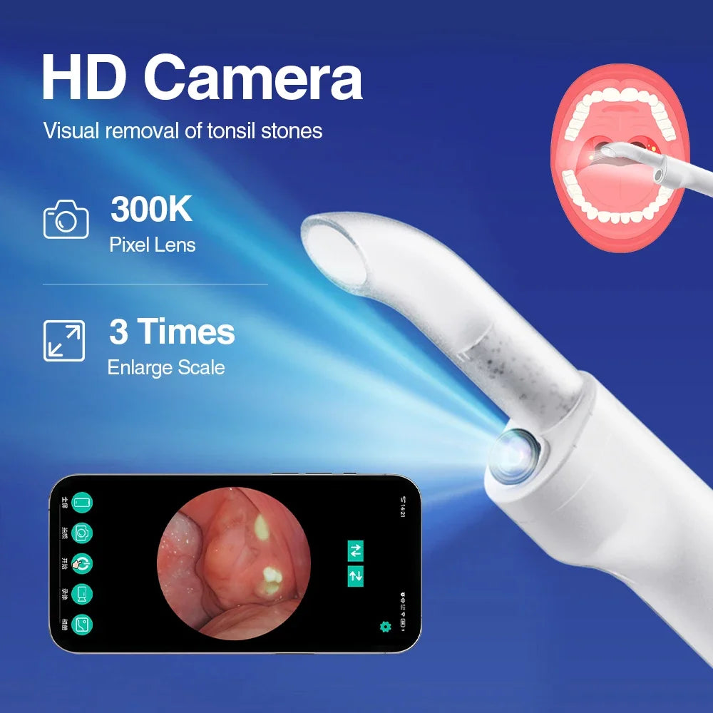 HD Visual Tonsil Stone Removal Vacuum Tool - 2