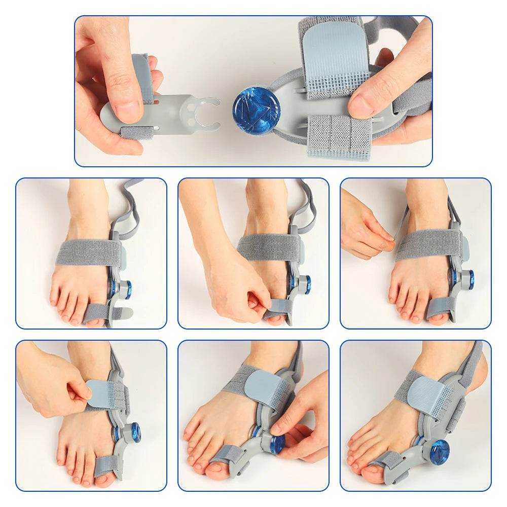 Adjustable Bunion Corrector and Toe Straightener Brace - 17