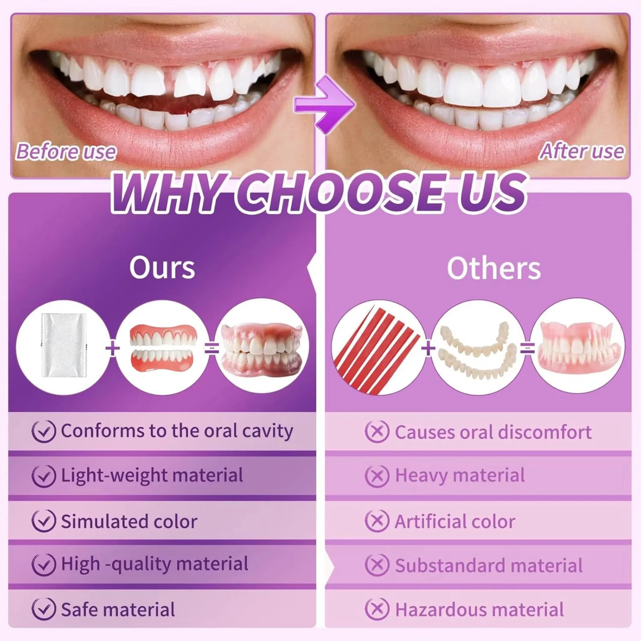 Instant Smile Silicone Upper and Lower Denture Set - 3