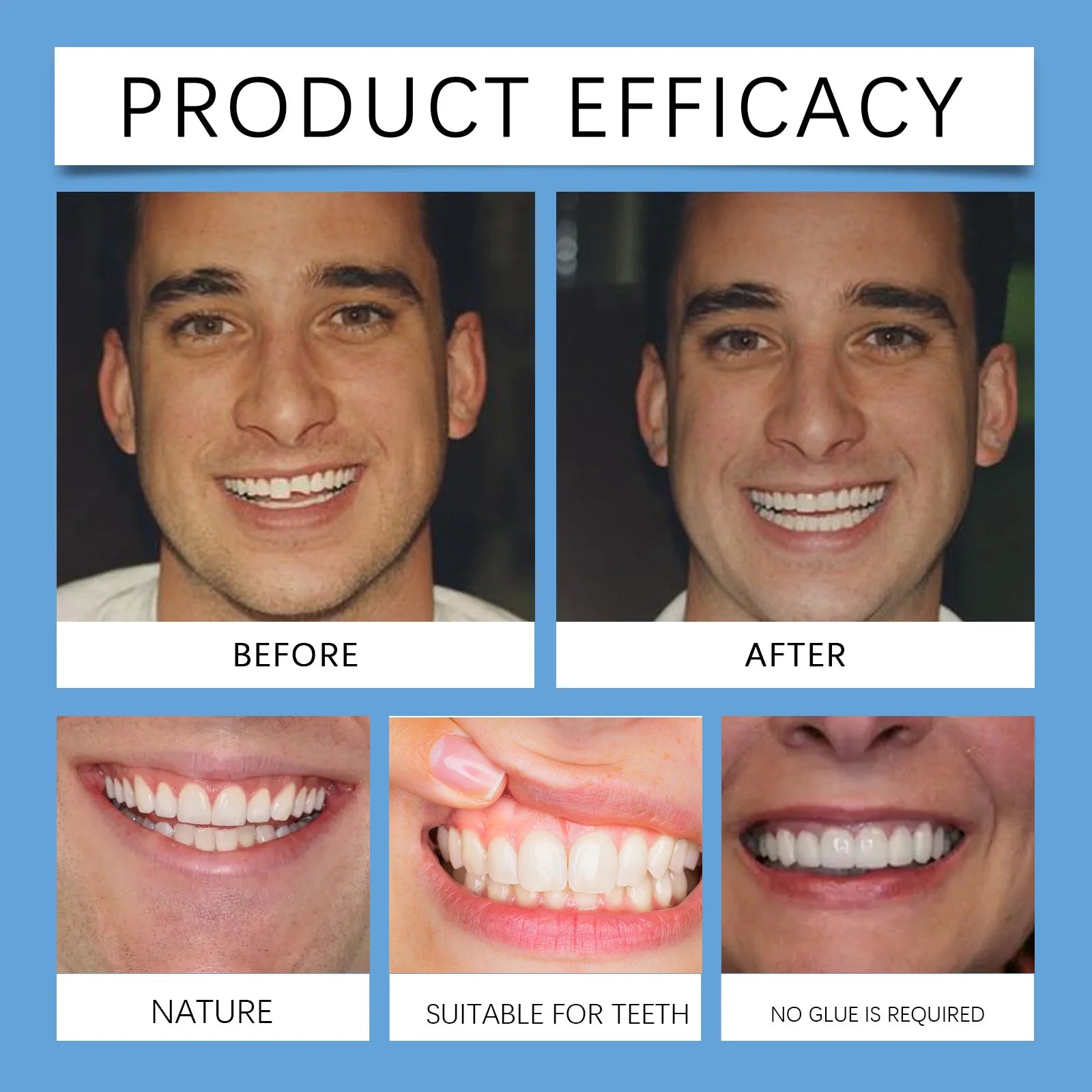 Adjustable Snap-On Smile Veneers for Missing or Broken Teeth - 18