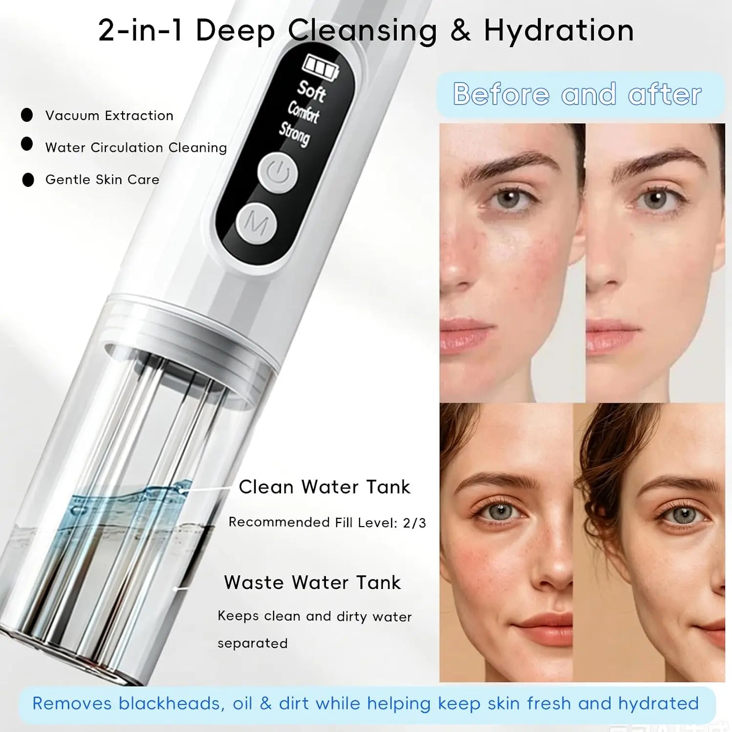 Hydrating Electric Pore Vacuum Blackhead Remover - 2