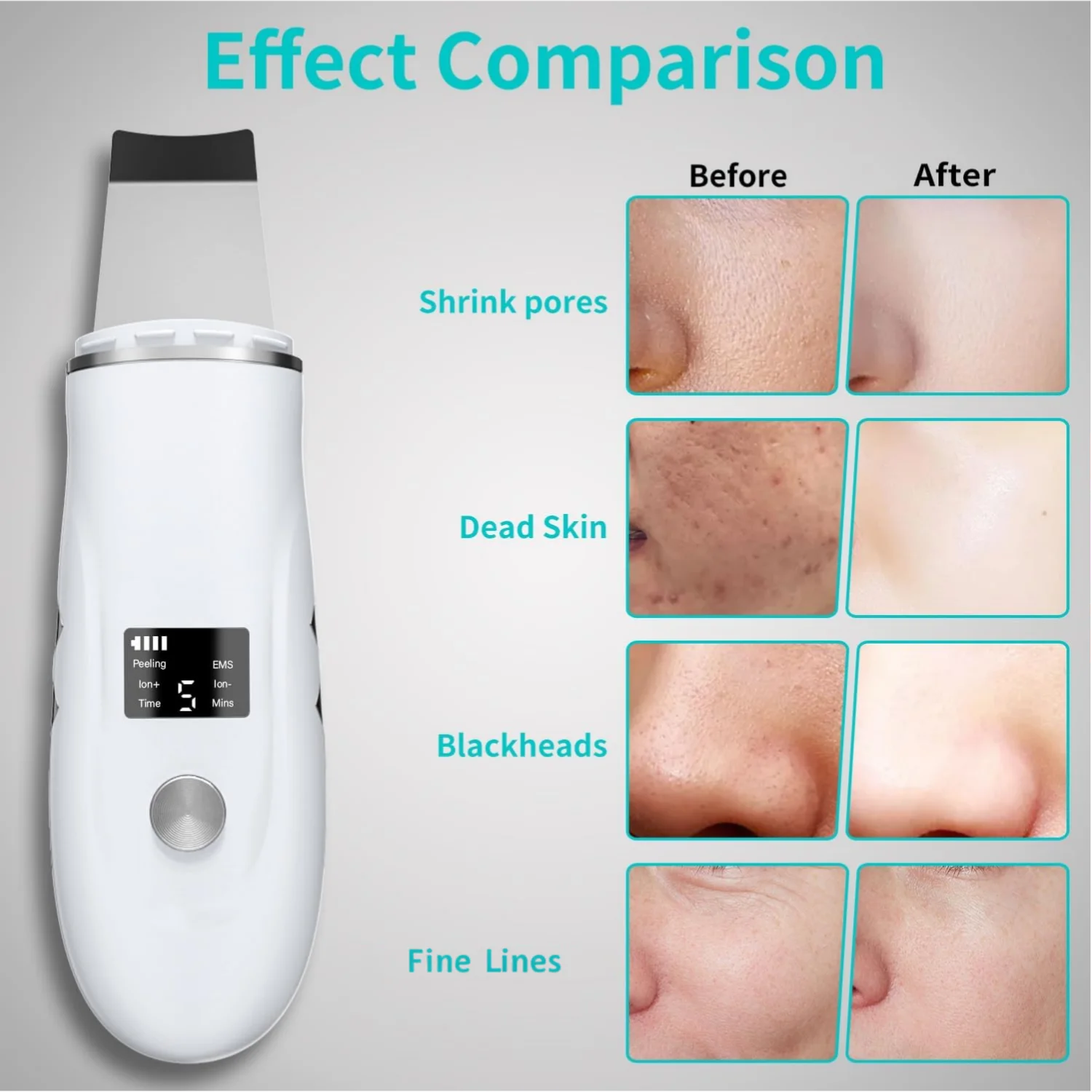 4-in-1 Ultrasonic Facial Skin Scrubber and Pore Cleaner - 3