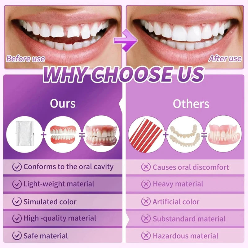Comfort Fit Silicone Cosmetic Dentures for Instant Smile
