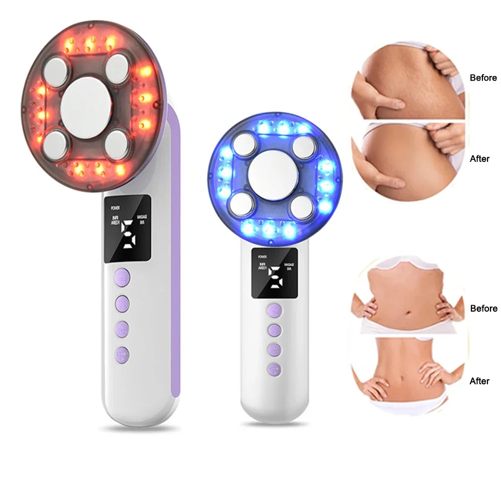 3-in-1 Ultrasonic Body Slimming and Skin Tightening Massager