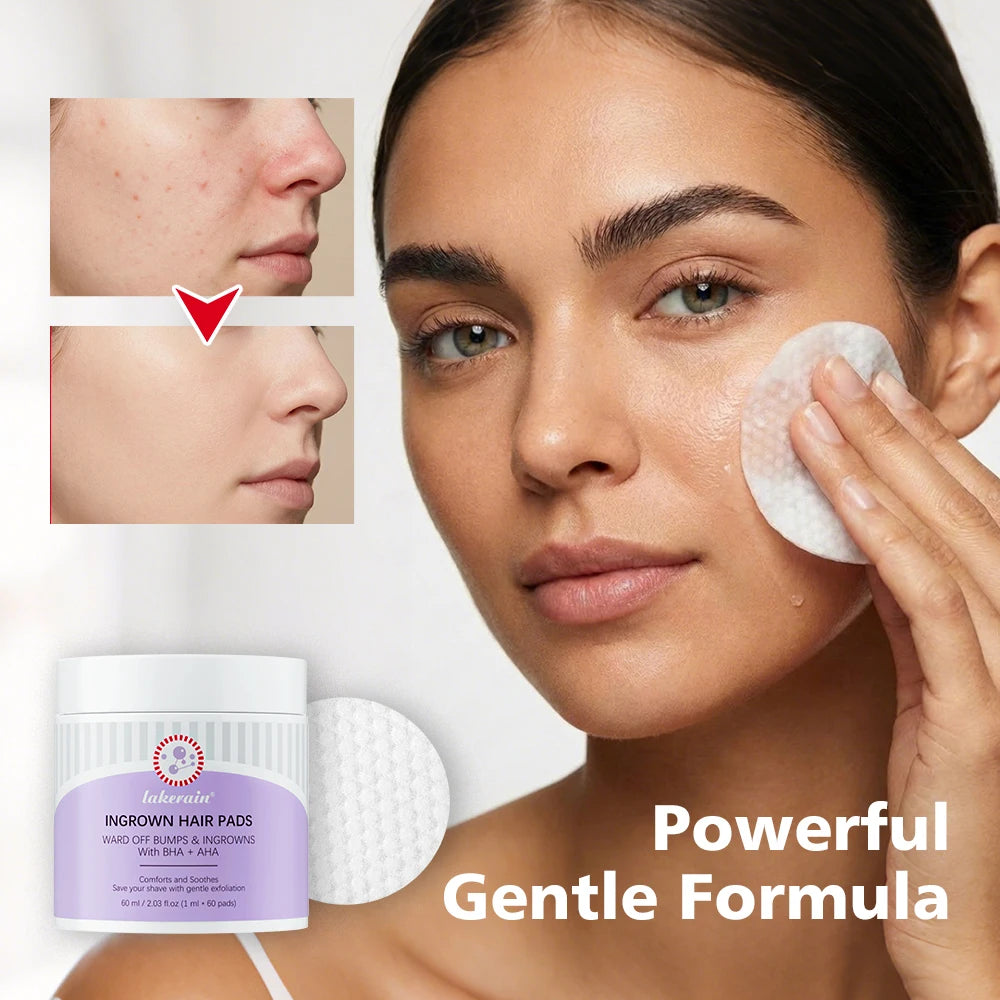 Exfoliating Ingrown Hair Treatment Pads for Razor Bumps - 10