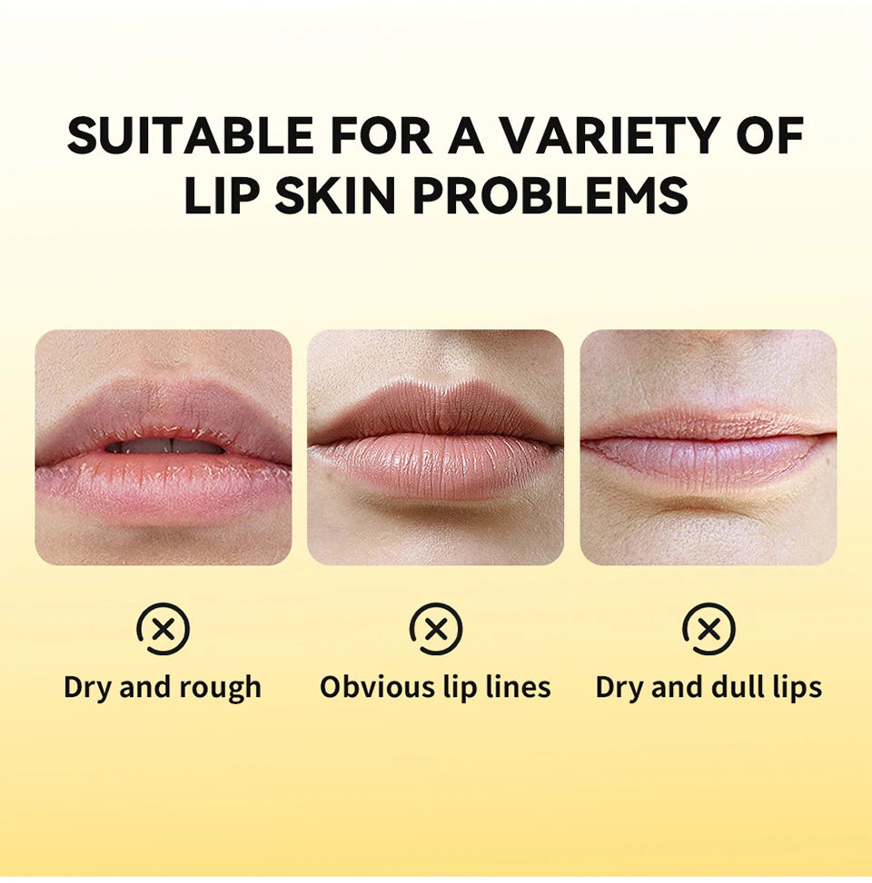 Propolis Hydrating Overnight Lip Repair Gel - 8