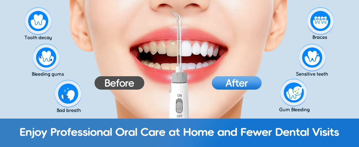 Electric Water Flosser with 8 Nozzles for Deep Oral Cleaning