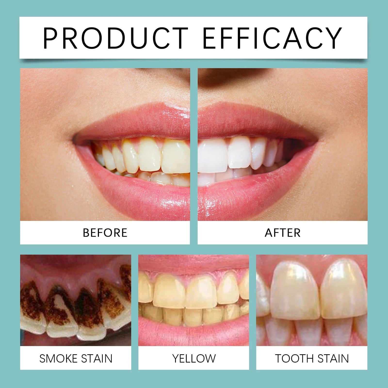 Instant Teeth Whitening Paint for Bright Smile - 11