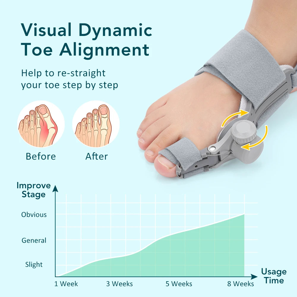 Adjustable Bunion Corrector and Toe Straightener - 16