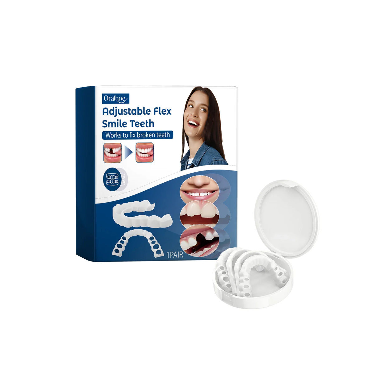 Adjustable Snap-On Smile Veneers for Missing or Broken Teeth