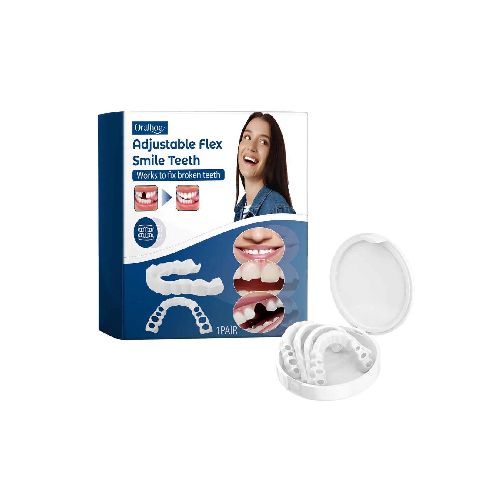 Adjustable Snap-On Smile Veneers for Missing or Broken Teeth - 21