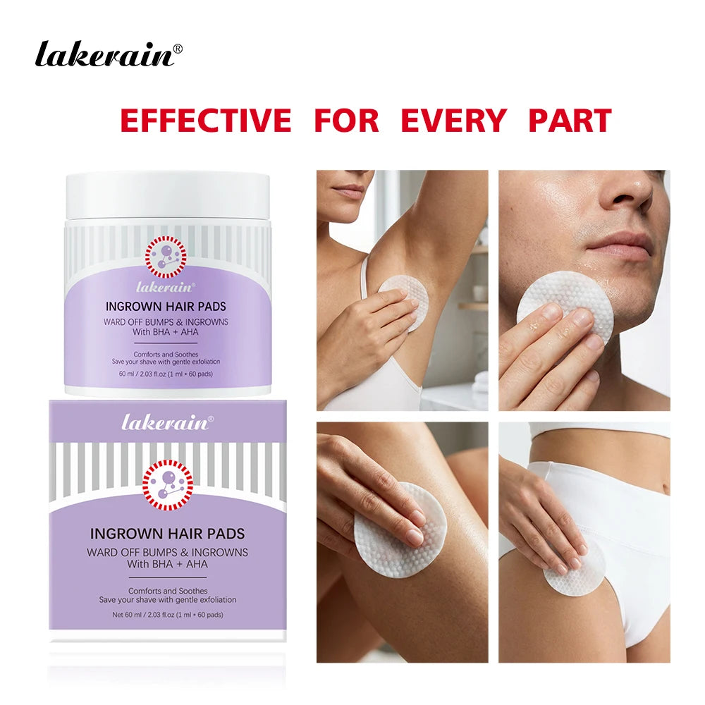 Exfoliating Ingrown Hair Treatment Pads for Razor Bumps - 1
