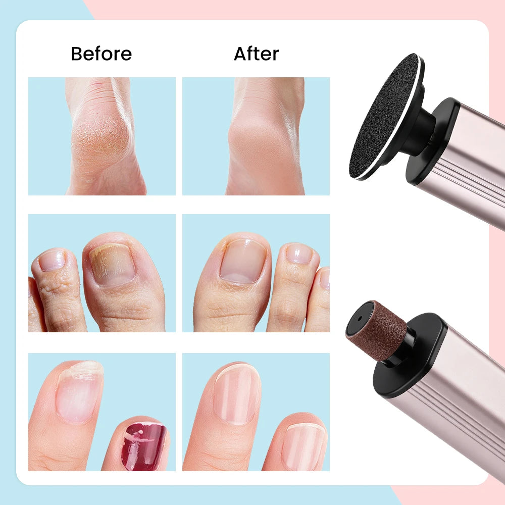 Electric Rechargeable Foot Callus Remover with 9 Speed Settings - 6