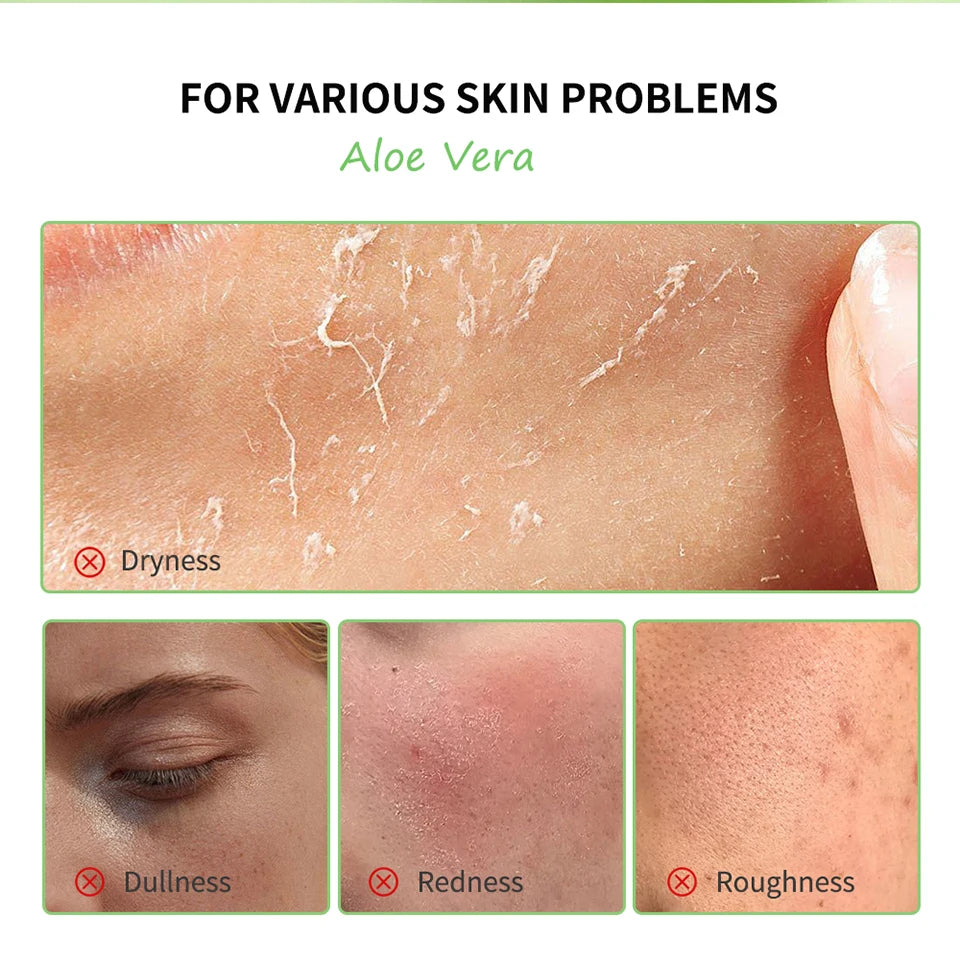 Soothing Aloe Vera Moisturizing Face Gel - 8