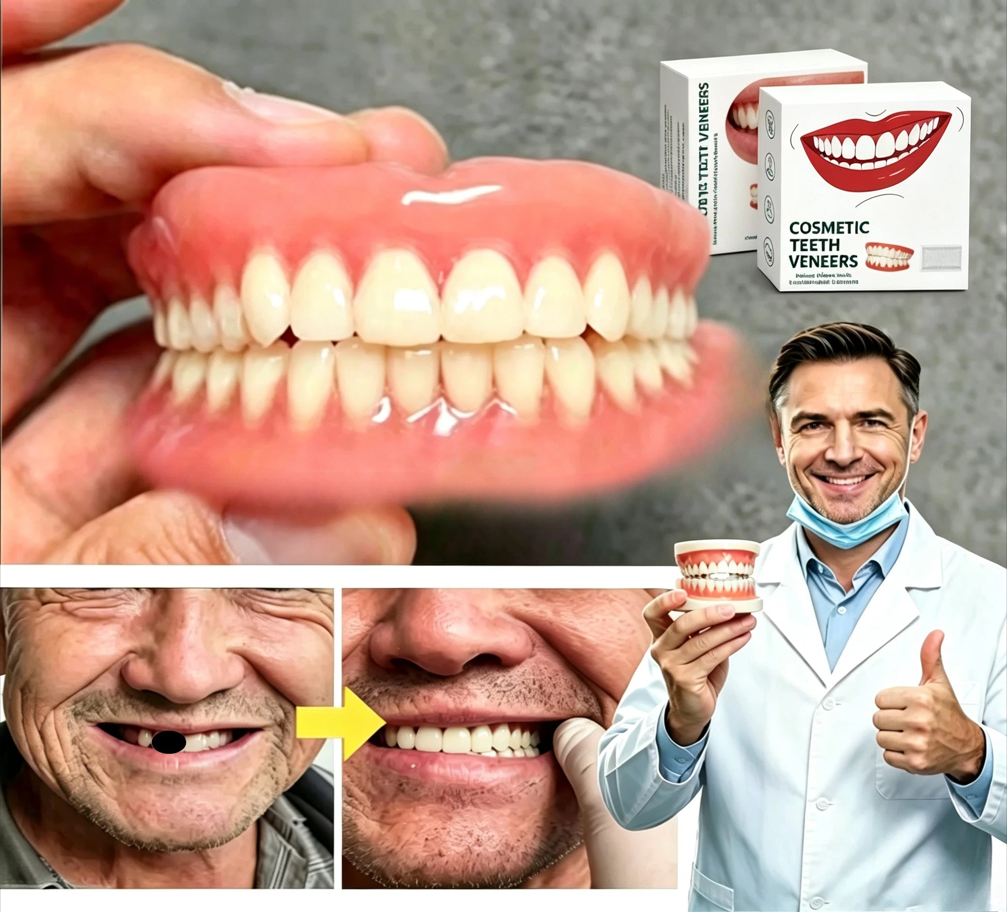 Custom Fit Cosmetic Smile Veneers for Instant Teeth Restoration - 4