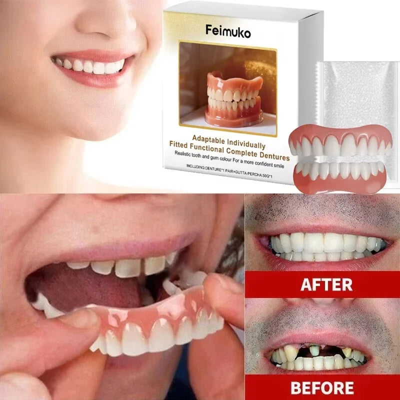 Custom Fit Cosmetic Denture and Reline Kit for Confident Smile - 2