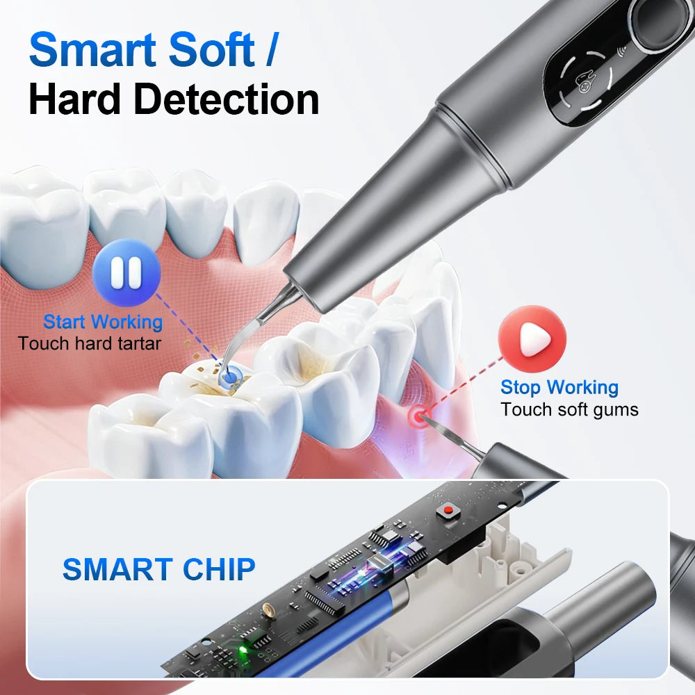 Visual Ultrasonic Dental Scaler with HD Camera for Teeth Cleaning - 5