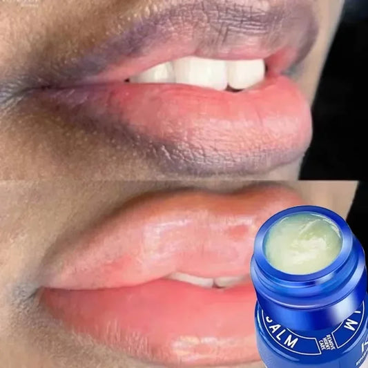 Moisturizing Lip Balm for Dark Lip Correction and Repair
