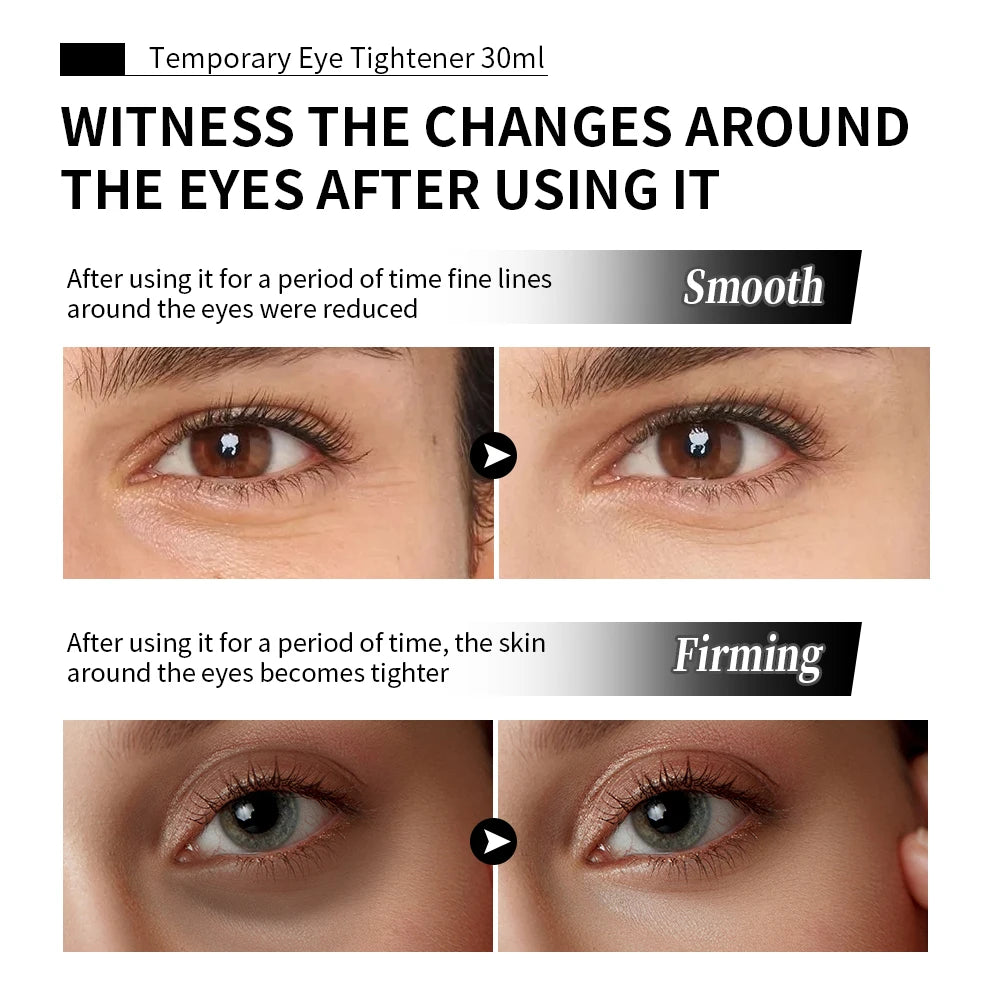 Instant Temporary Eye Tightening Firming Cream