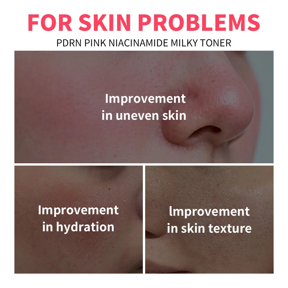 PDRN Niacinamide Milky Toner for Radiant Hydrated Skin
