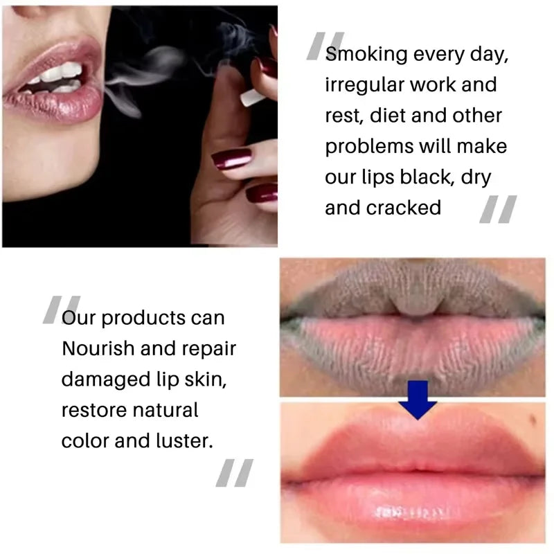 Moisturizing Lip Balm for Dark Lip Correction and Repair - 6