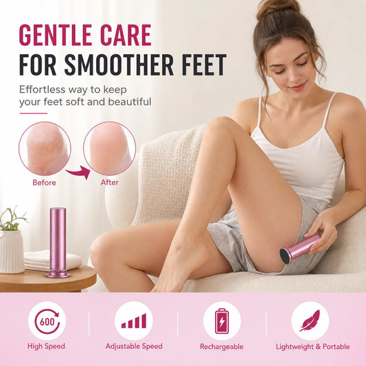 Electric Callus Remover for Smooth Heels and Pedicure