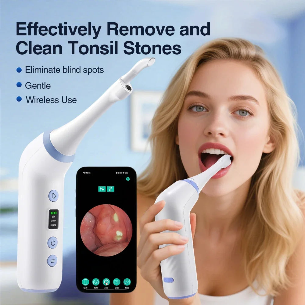 HD Visual Tonsil Stone Removal Vacuum Tool - 1